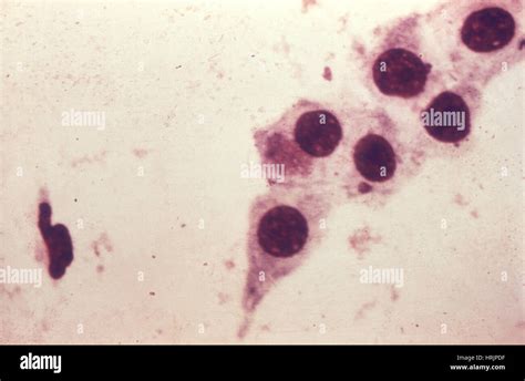 chlamydia trachomatis bacteria gram.